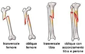 traumatologia